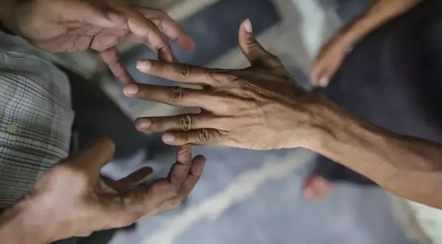 بعد 44 عامًا، حدث غير مسبوق! تم تسجيل حالات من الجذام في بلدين.