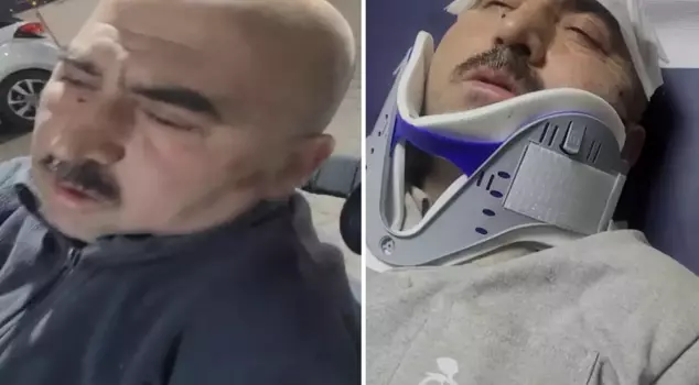 An employee working without insurance was brutally beaten by the boss and his son.