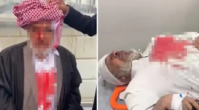 В Шанлыурфе 4 ареста за избиение палкой.