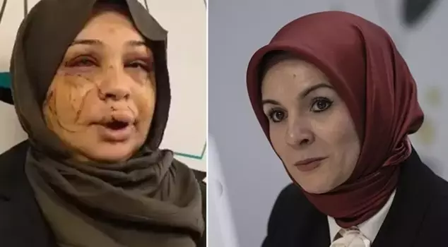 الوزير غوكطاش: نحن مع أخينا الذي تعرض للعنف، وسنشارك في القضية.