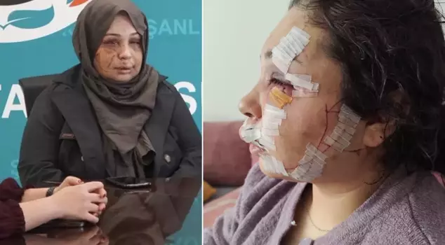 تم اعتقال أفراد من إدارة حماية الرئيس الذين جعلوا زوجته بهذه الحالة.