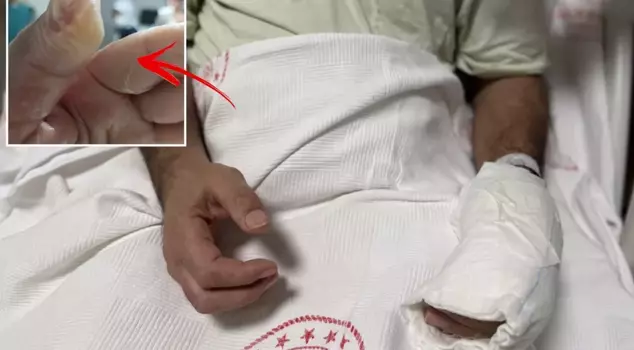 Опасность, которая есть у каждого дома! 30% его тела сгорело.