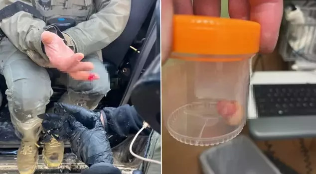 Shocking claim in anti-ICE protests: They bit off an officer's finger.