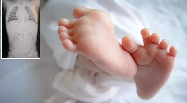 1-летний ребенок всегда плакал, когда его укладывали на спину! Семья была шокирована, узнав правду.