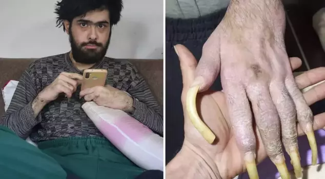 Те, кто видит новую работу Бариша, о которой говорит Турция, и его последнее состояние, остаются в полном восторге.