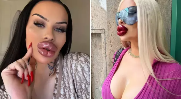 The phenomenon who spent 60 thousand dollars on aesthetics: I can no longer keep my mouth shut.