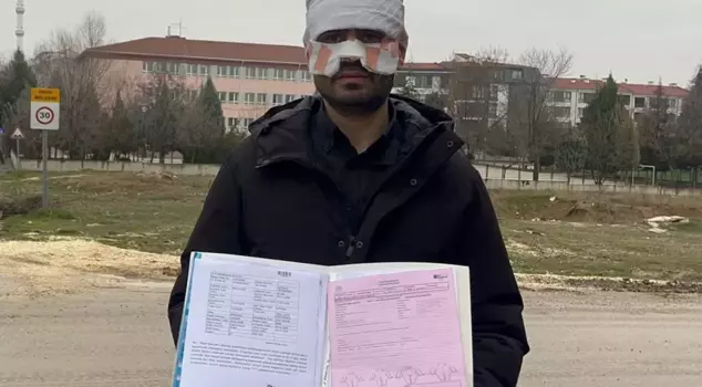 The physics teacher, to whom the guidance counselor threw hot tea in the face, was severely burned.