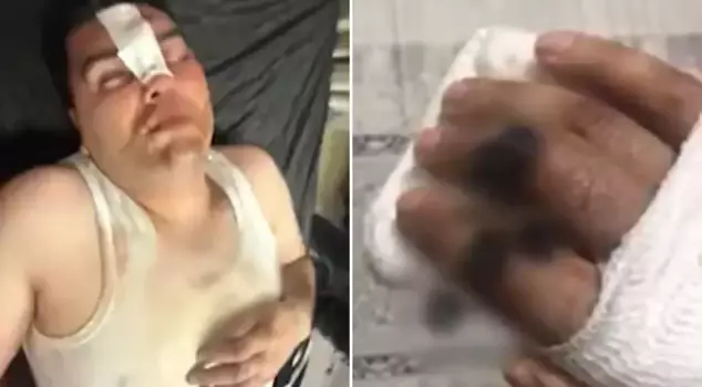 They shared the bill, but he took the beating alone! Everything started with a 13 thousand 