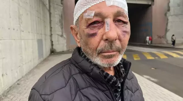 They wanted to light it, and then it ended up like this.