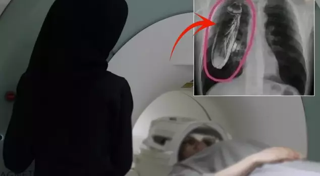 The patient was told, 