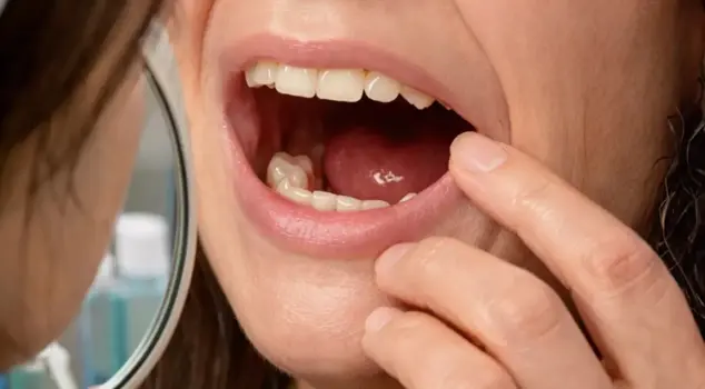 When she woke up in the morning, she had no teeth! The real condition that surprised even the doctors emerged in the hospital.