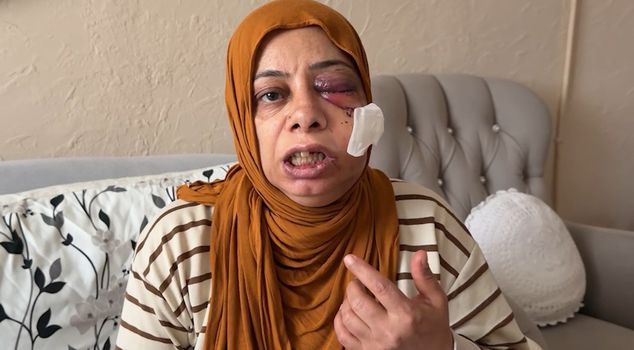 عندما ذهب لزيارة الأقارب أصبح بهذه الحالة