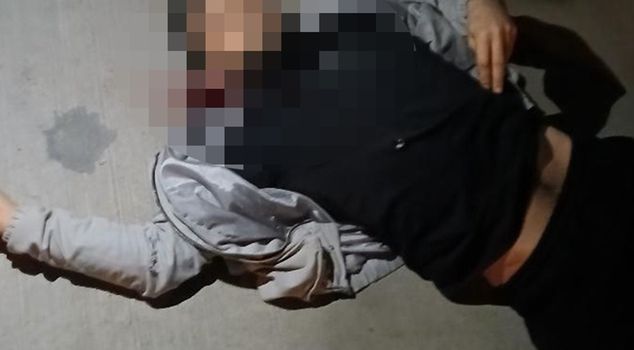 Он застрелил своего брата из помпового ружья.