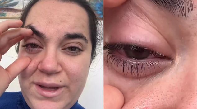 The dishwasher tablet exploded in the woman's eye, and she experienced a fear of going blind.