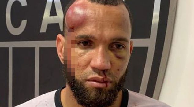 In the football battle where 23 red cards were issued, the goalkeeper became unrecognizable.