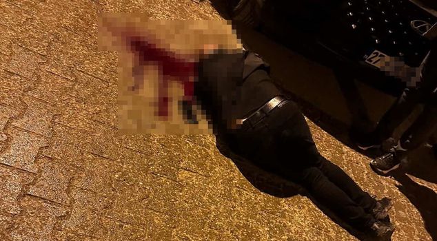 He was shot in the head with a gun while walking down the street.