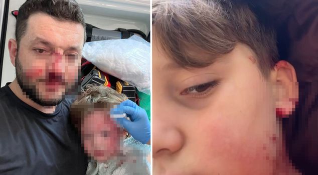 В Ялове конфликт нарастает: 8-летний ребенок из одной семьи также пострадал.