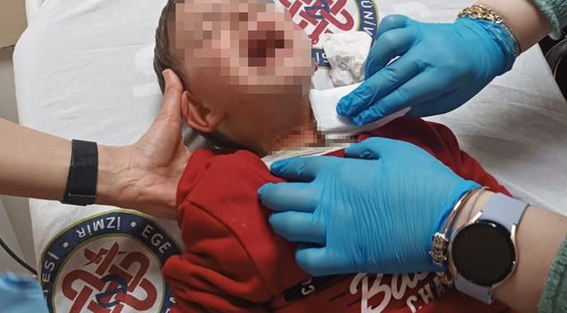 Horror in Izmir park: 2-year-old child stabbed.