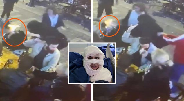 He had burned his same-sex partner with cologne in Kadıköy; his first words in court were 