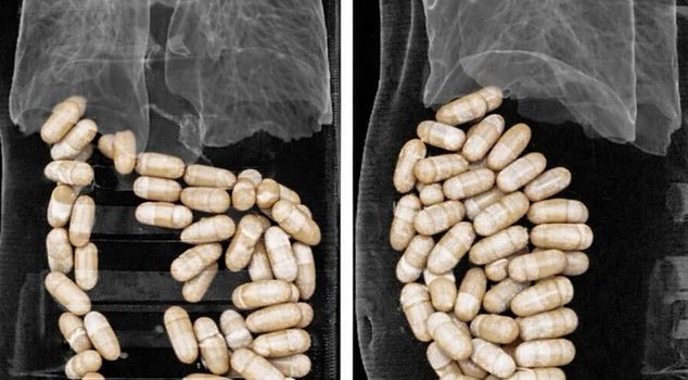 In Izmir, 1 kilogram and 304 grams of drugs were found in the stomachs of 2 suspects.