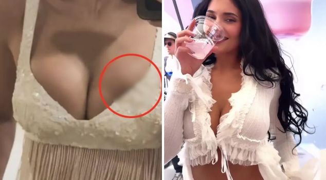 Millions of fans are searching for the answer to this question: Did Kylie Jenner's silicone burst?