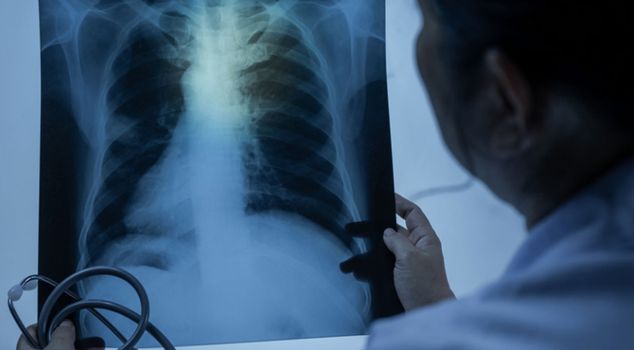 يمكن لمكيفات الهواء غير المُصانة والملابس المُجففة أن تُسبب ضررًا دائمًا للرئتين