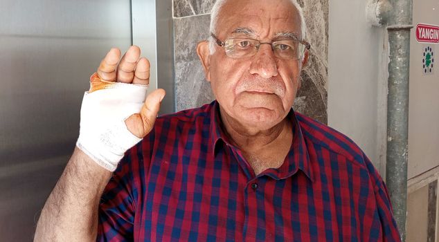 The finger bitten by the neighbor was amputated.