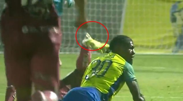 إصابة لاعب كرة القدم الشاب بكسر في ساقه! لحظات الإصابة بالكاميرا