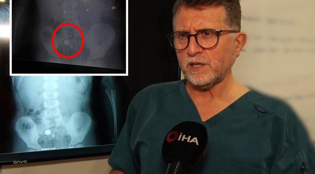 He thought it was candy and swallowed it, it turned out to be a battery in the film: It can lead to death
