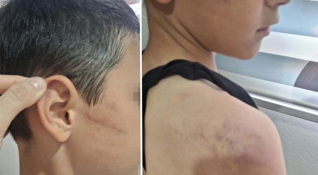تم إيداع الطفل الذي ضربه والده لأنه طلب مصروفًا من معلمه تحت حماية الدولة
