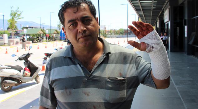 Istanbul Provincial Health Director Güner: 767 people were injured during the sacrifice slaughter.