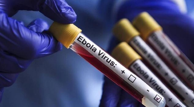 New measures against Ebola virus from TRNC
