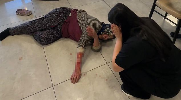 The aggressive dog tore off the woman's arm