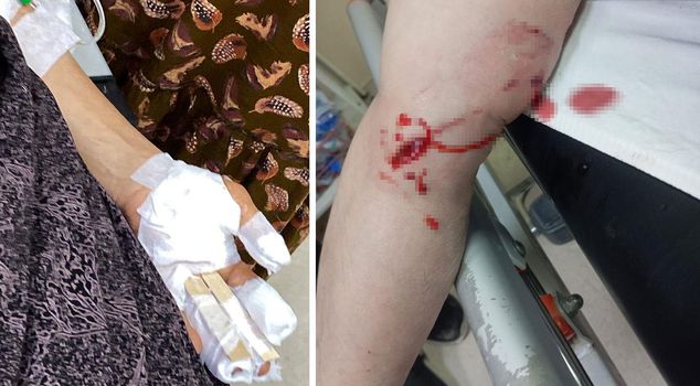 Street dog horror in Şırnak: 3 women experienced nightmare in front of their homes