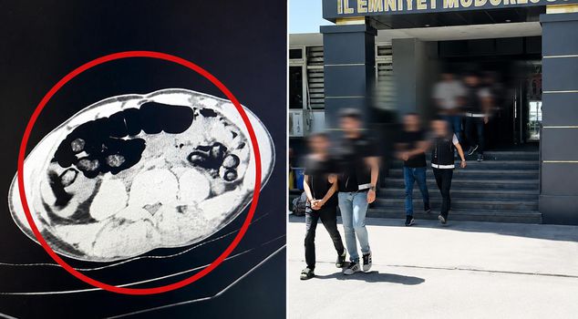 Mind-boggling incident in Batman: Drugs weighing kilos were extracted from the stomachs of 4 suspects caught on a passenger bus.