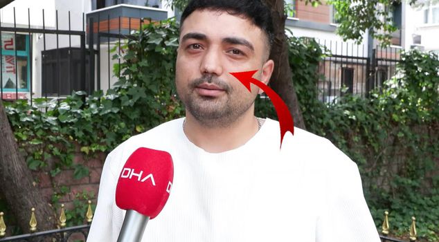 He had nose surgery, and everything that could go wrong went wrong! He even lost his job.