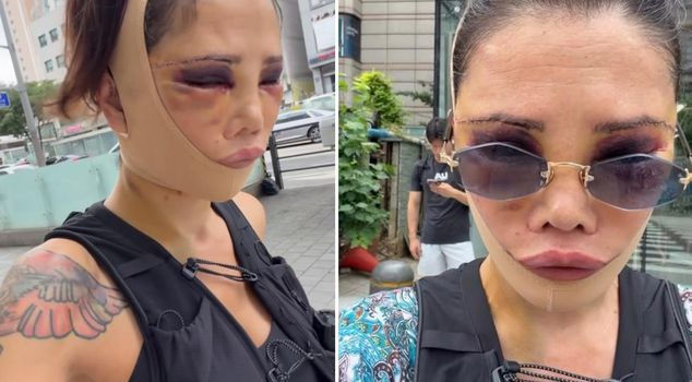 نجمة Survivor السابقة ديدم جران في حالة لا يمكن التعرف عليها