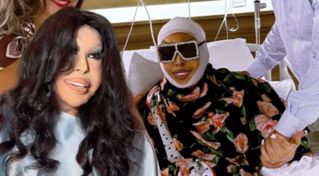 Bülent Ersoy on stage for the first time after plastic surgery: How do you like it?