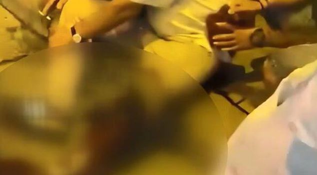 تحول هجوم بيت بول إلى شجار: صاحب الكلب طُعن في 3 أماكن