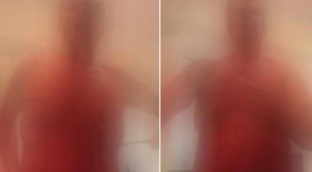 The influencer who harmed himself with a knife during a live broadcast has been hospitalized.