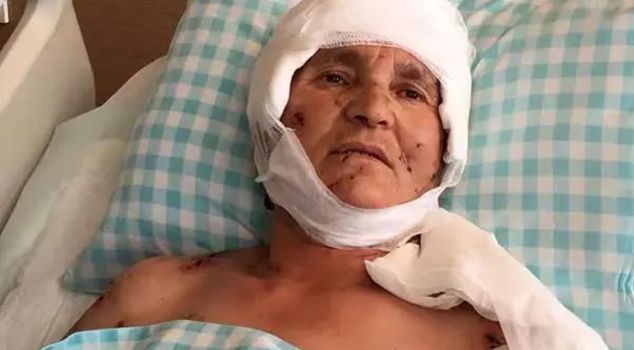 Пожилая женщина пережила ужас перед своим домом: Верховный суд вынес прецедентное решение по нападению собаки