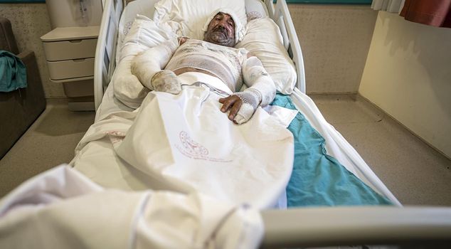 When he entered the house smoking, the gasoline canister ignited, and he ended up hospitalized along with his wife who came to help.