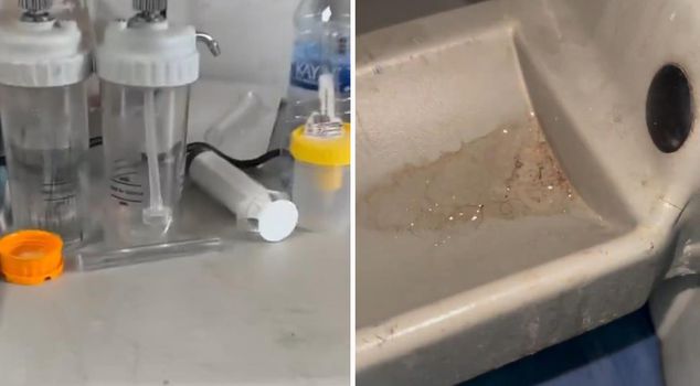 Nauseating images at GATA! The Ministry of Health has launched an investigation.