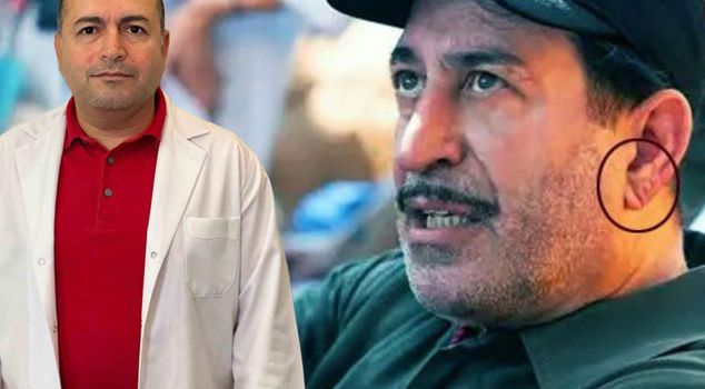 After Cem Yılmaz, expert warned! Take a good look at your ear in the mirror
