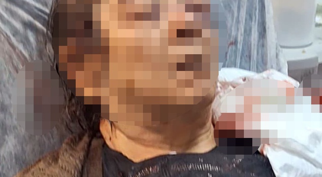 While she was sitting at home in Kayseri, the ceiling plaster collapsed on her! Severe vision loss in the left eye of the 75-year-old woman