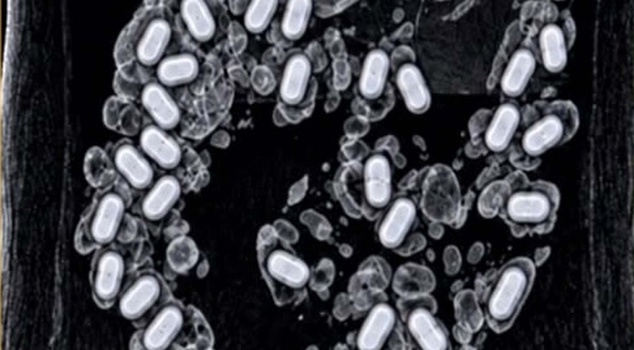 47 capsules of methamphetamine were found in the stomach of a suspicious passenger at Izmir airport! The passenger was arrested.