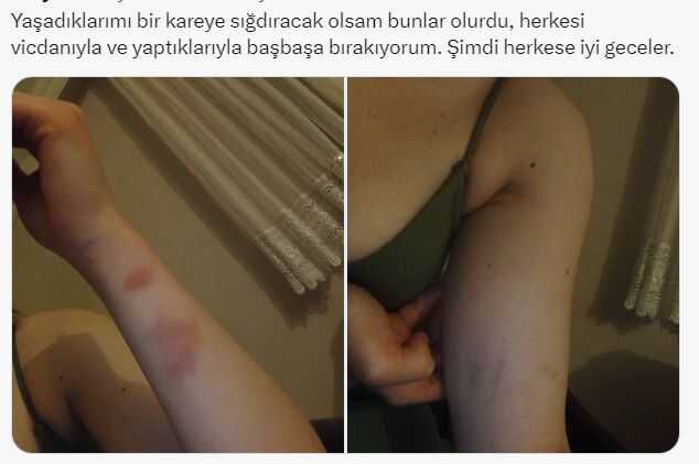 Üniversite öğrencisi, cinsel ilişki teklifini reddeden sevgilisini darbetti