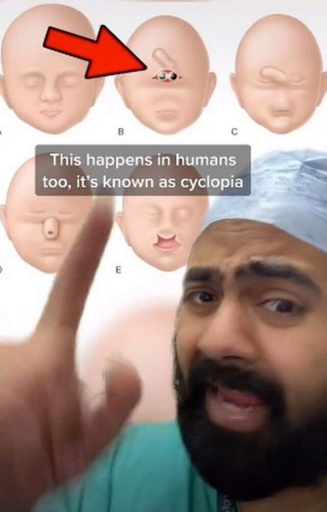 Kıyamet alameti olarak biliniyor! Tek gözlü oğlak tüyleri diken diken etti