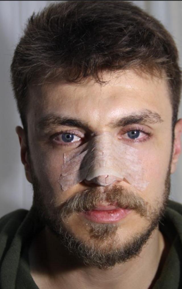 'Erkek hekim bakmasın' deyip eşini çağırdı! Öfkeli koca doktorun burnunu kırdı