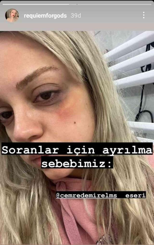 Cemre Demirel'in sevgilisi Nilsu kimdir? Cemre Demirel hakkında ne açıkladı?